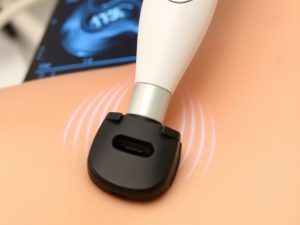 Dispozitiv de ultrasunete aplicat pe piele pentru tratament.